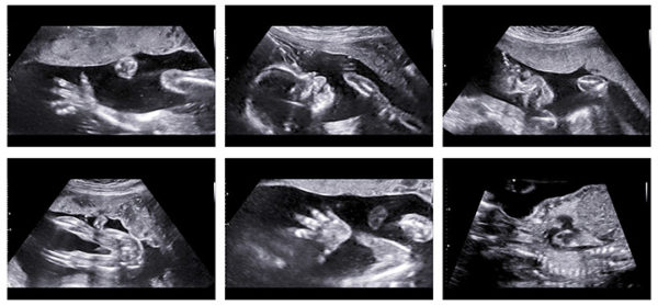 take a peek 3d 4d baby scans