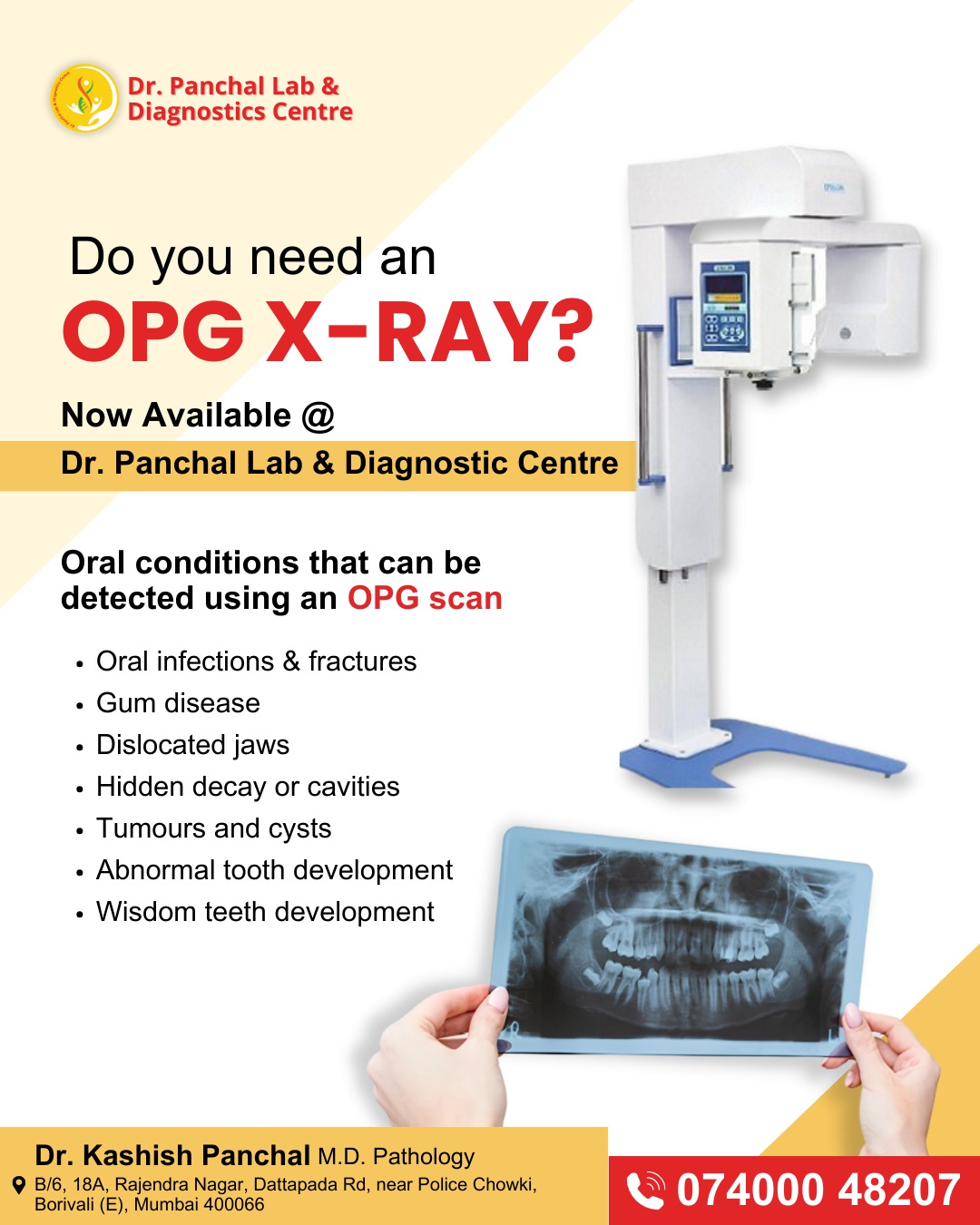 OPG Dental X-Ray